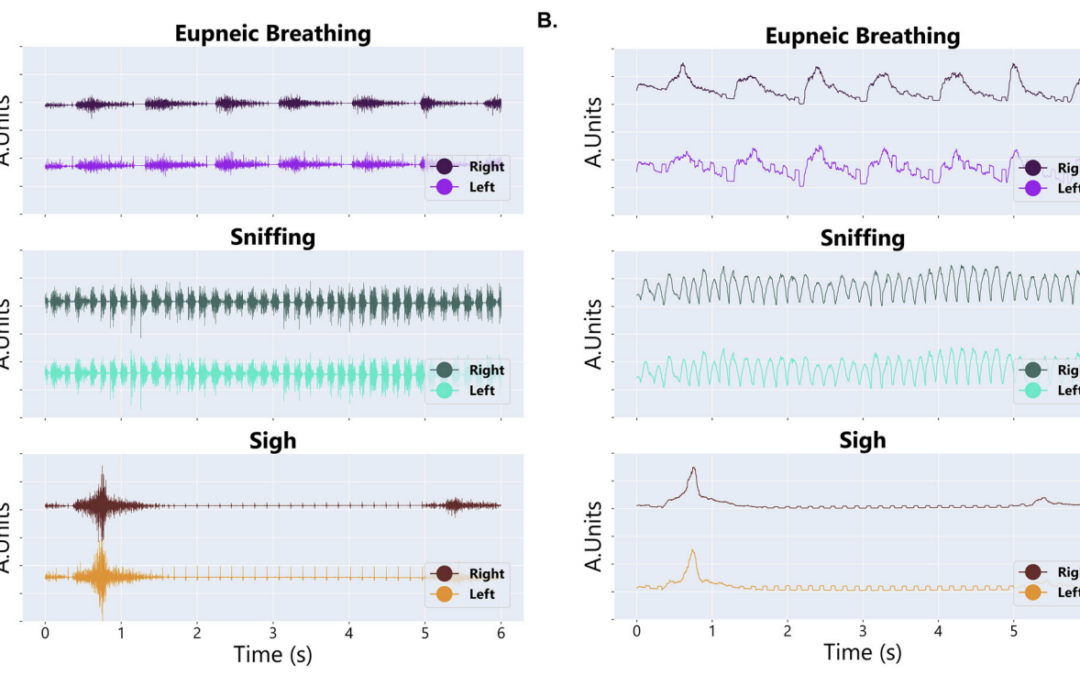 Implant for Reliable Diaphragm EMG Recordings in Awake, Behaving Rats